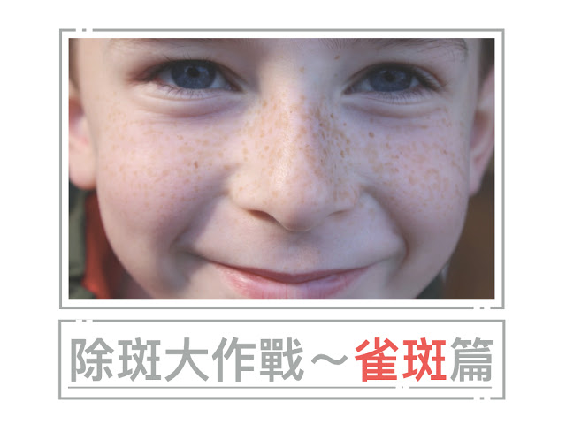 Read more about the article 除斑大作戰-雀斑篇