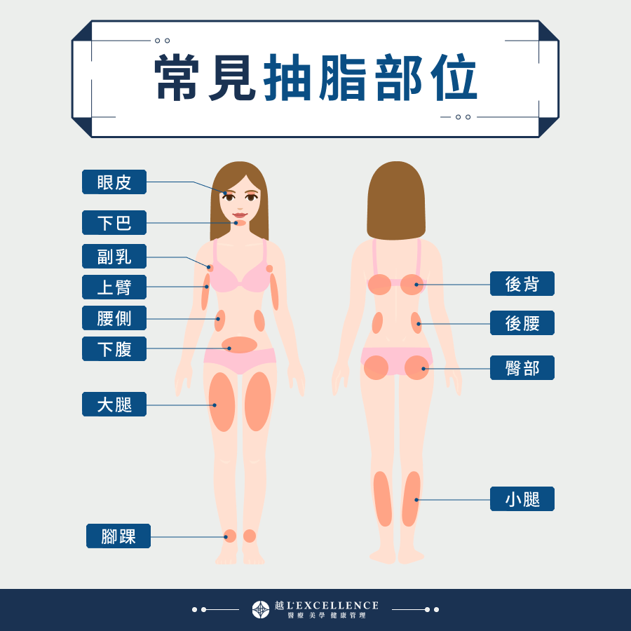 常見抽脂部位 眼皮 下巴 上臂 副乳 後背 下腹 腰側 後腰 臀部 大腿 小腿 腳踝