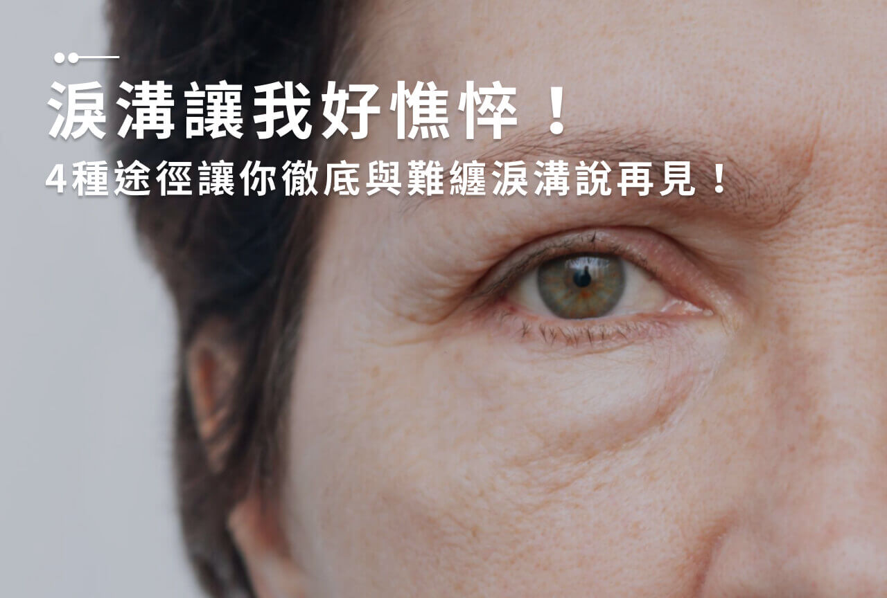 Read more about the article 淚溝是什麼？淚溝改善5重點，從淚溝形成看淚溝怎麼消！
