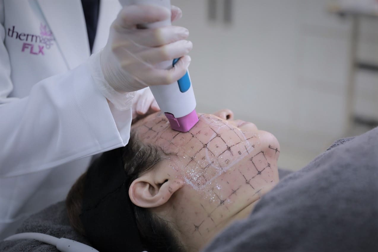 紫鑽智能探頭施打部位