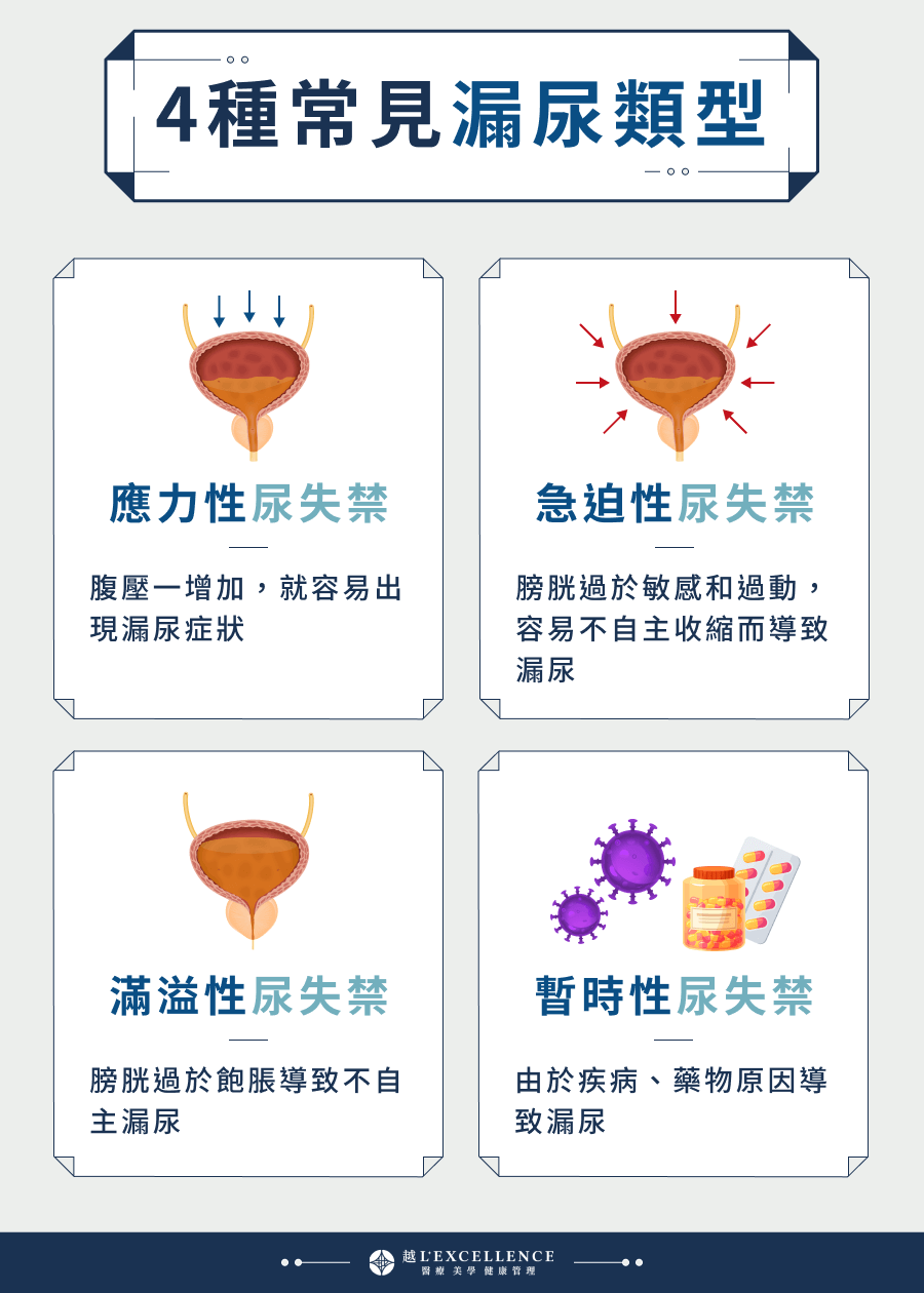4種常見漏尿類型