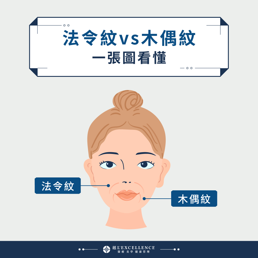 法令紋vs木偶紋