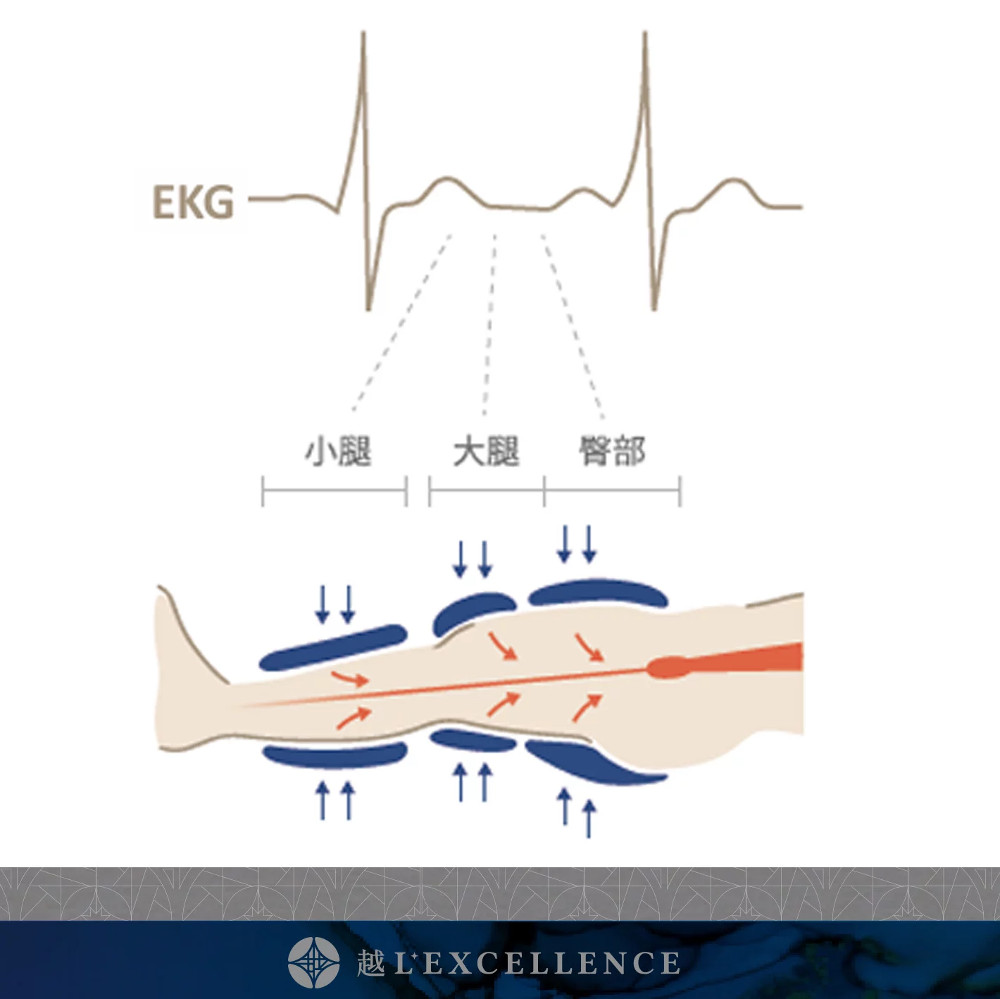 EECP、體外反搏、心臟復健、心絞痛改善、非侵入性心血管治療、血液循環療程、冠狀動脈輔助治療、促進血管新生 越診所 S04