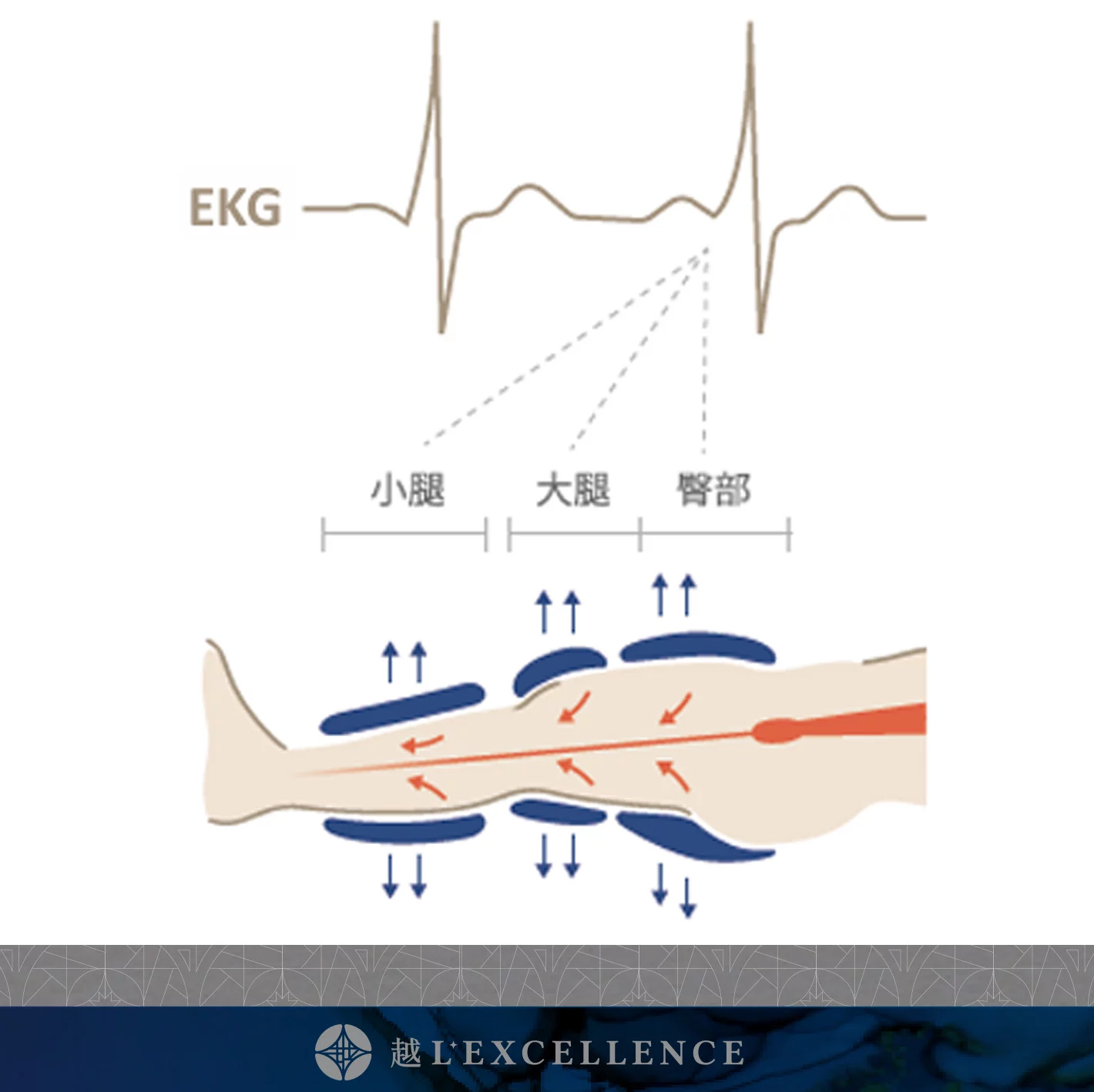 EECP、體外反搏、心臟復健、心絞痛改善、非侵入性心血管治療、血液循環療程、冠狀動脈輔助治療、促進血管新生 越診所 S05