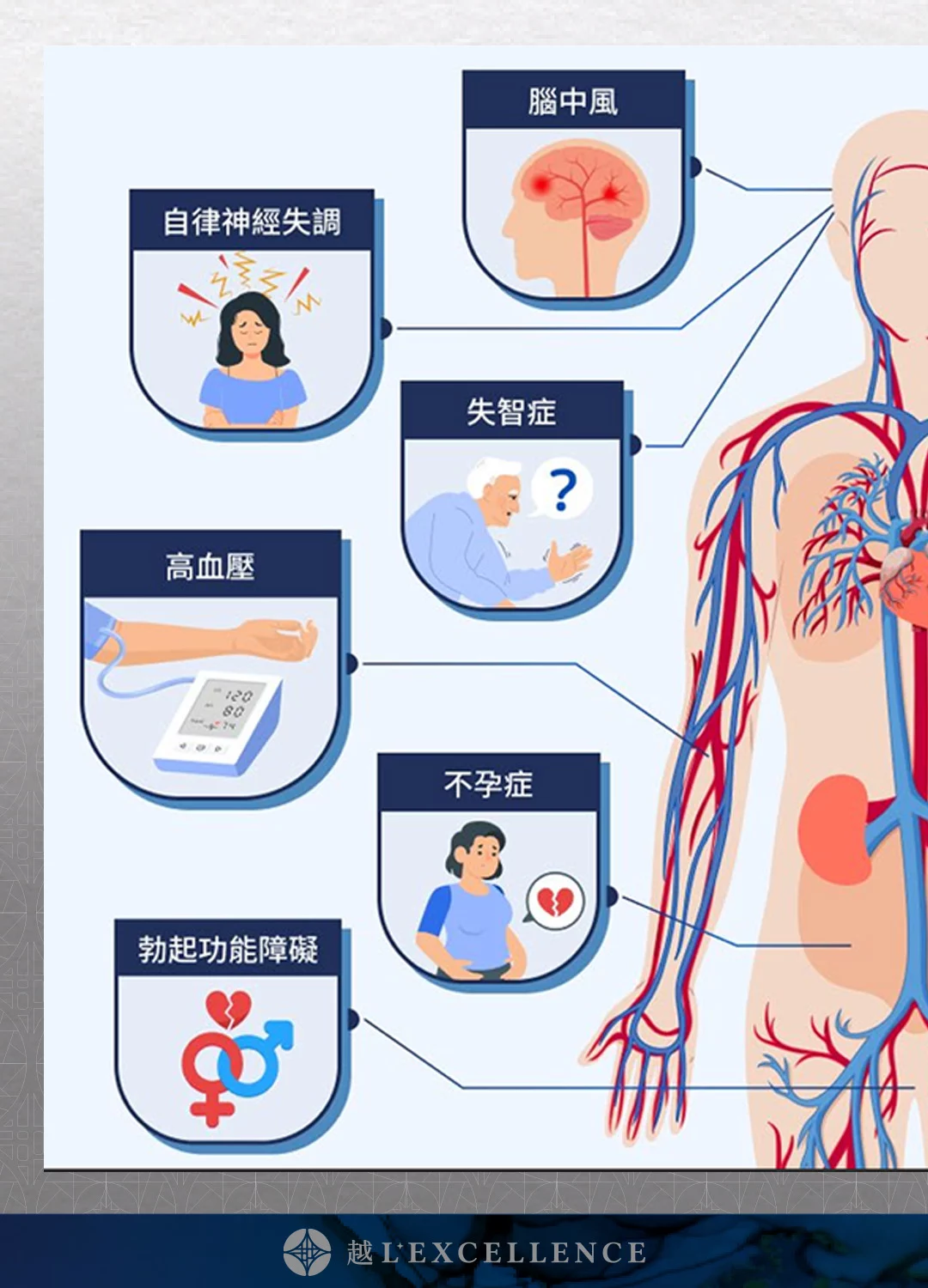 EECP、體外反搏、心臟復健、心絞痛改善、非侵入性心血管治療、血液循環療程、冠狀動脈輔助治療、促進血管新生 越診所 Mb03