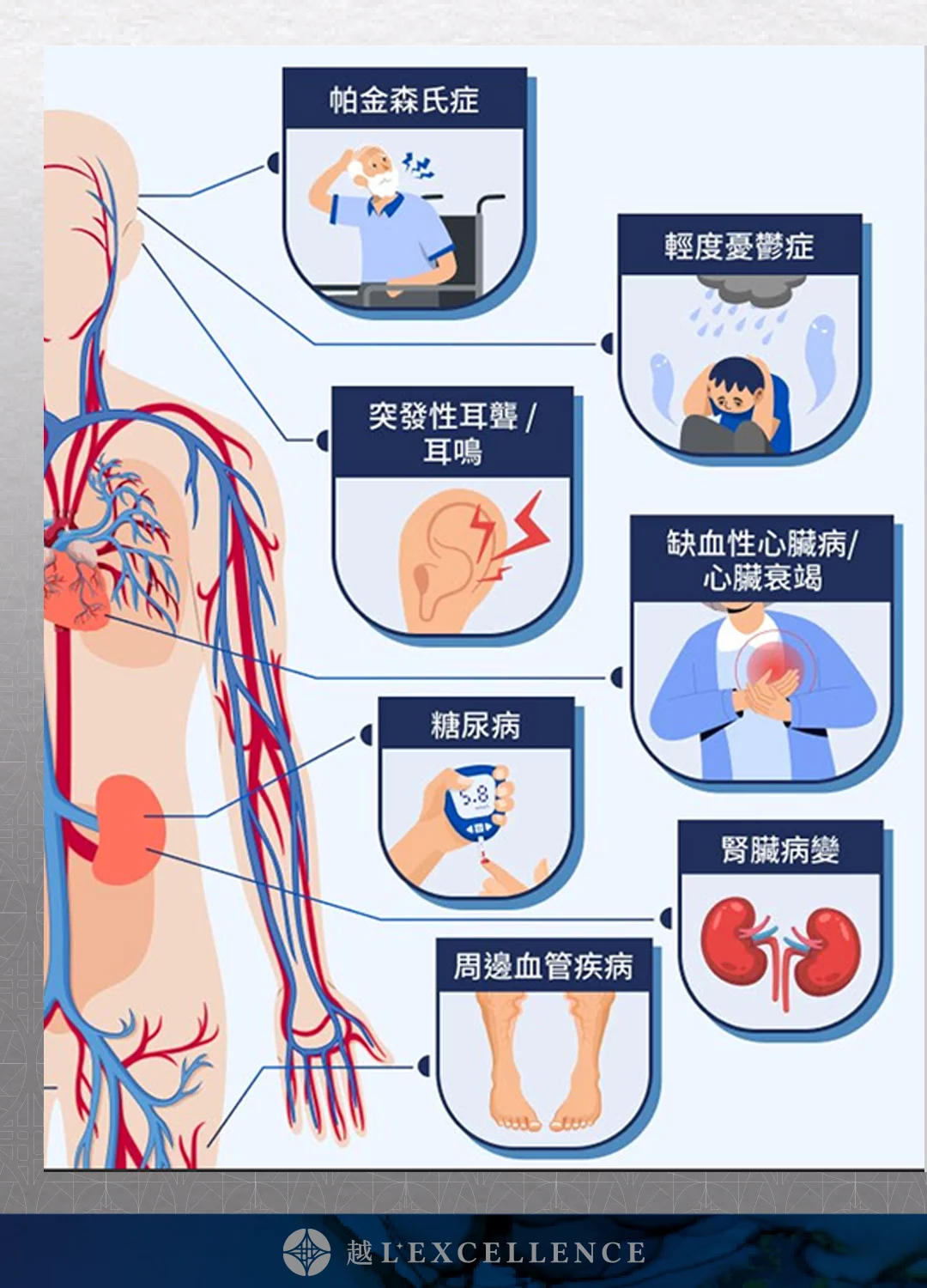 EECP、體外反搏、心臟復健、心絞痛改善、非侵入性心血管治療、血液循環療程、冠狀動脈輔助治療、促進血管新生 越診所 Mb04
