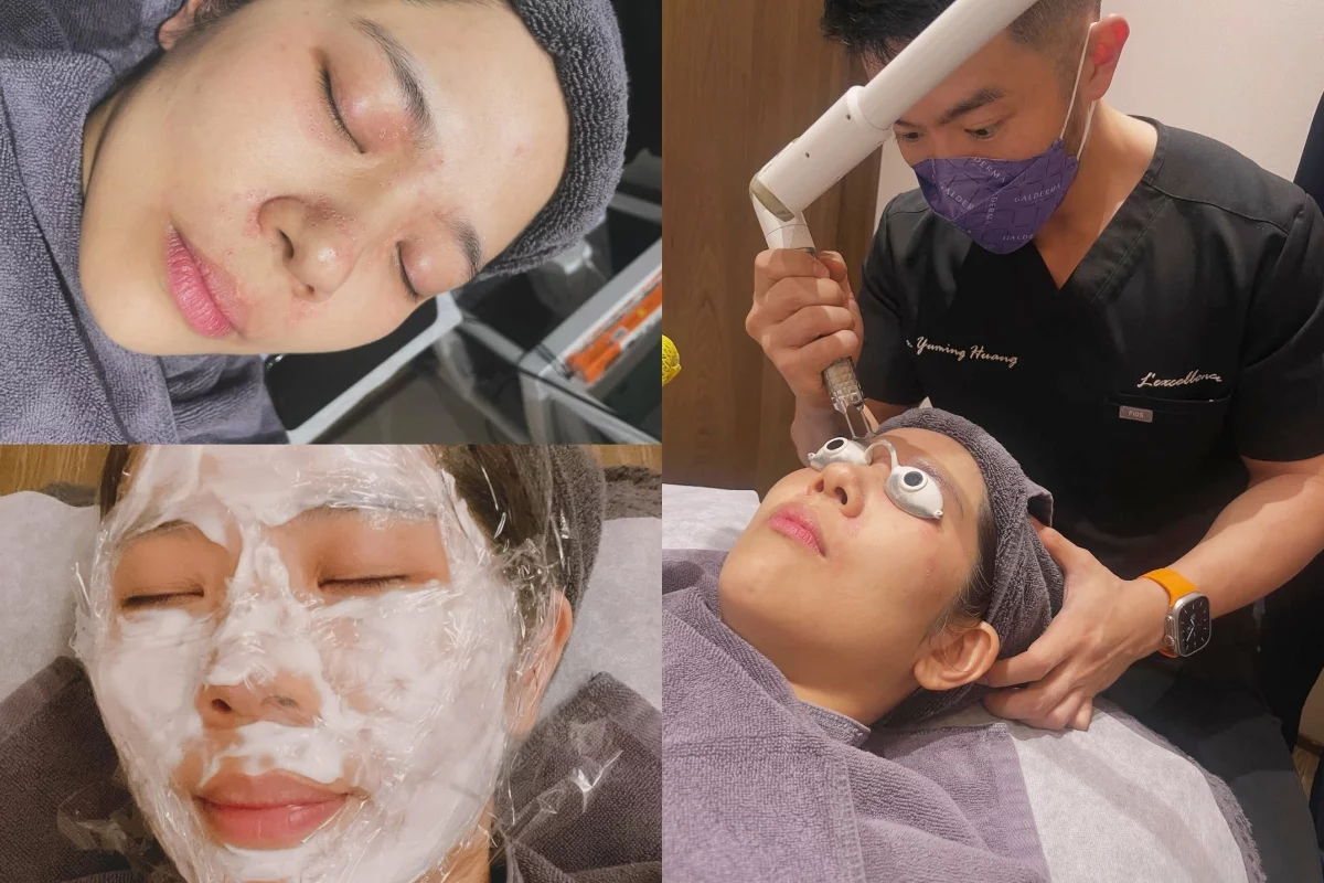 粟粒腫如何消除